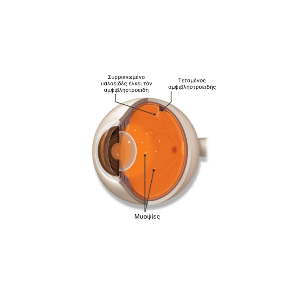 https://eyeservices.gr/wp-content/uploads/2025/04/eyes-services-miopsies-chart1.webp