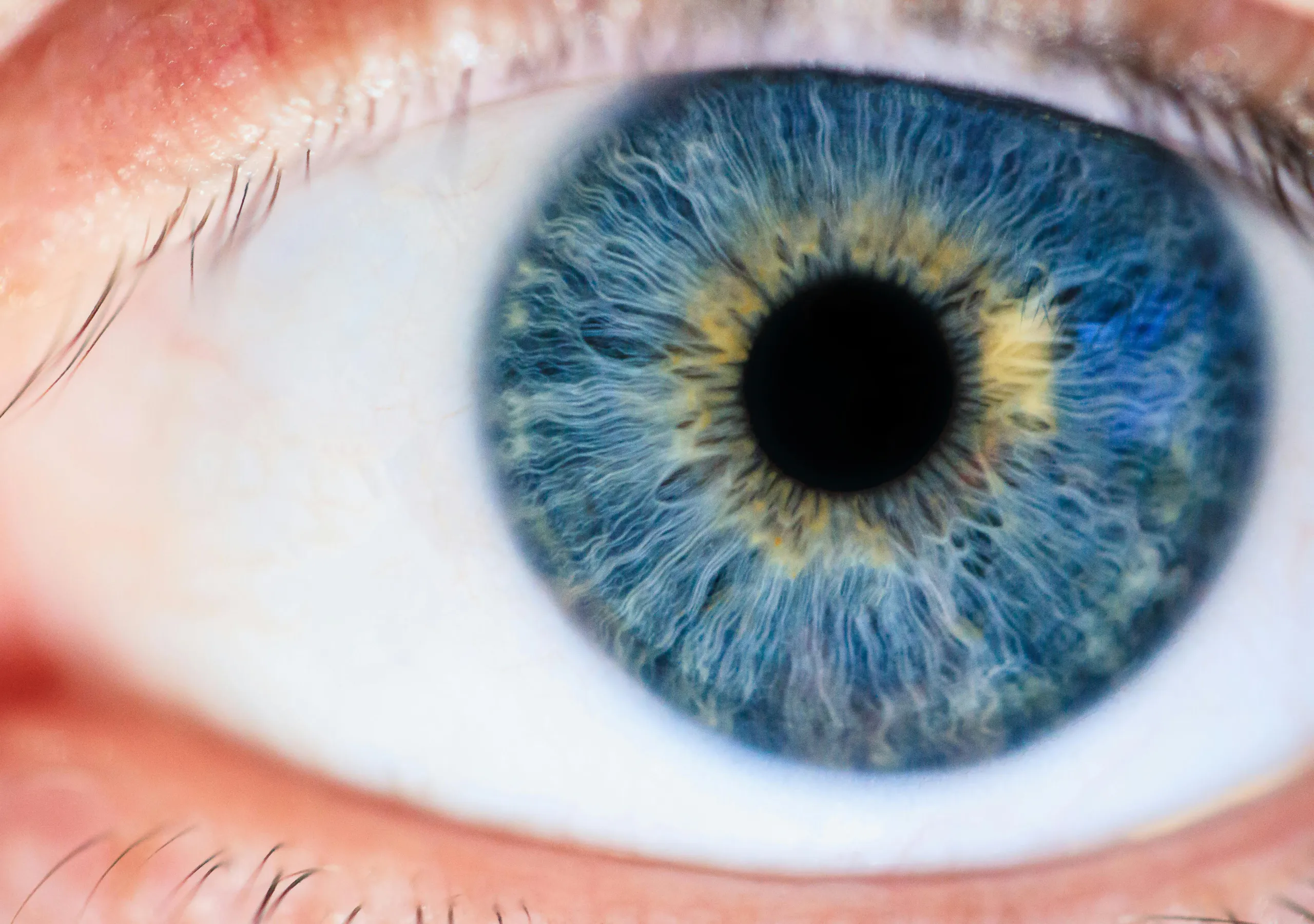 https://eyeservices.gr/wp-content/uploads/2025/04/iris.webp